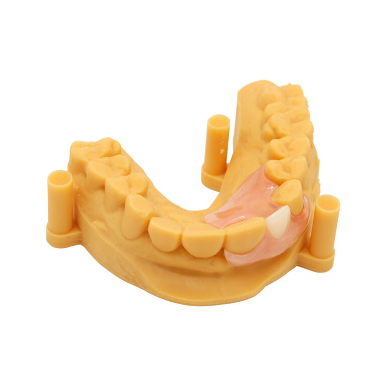 flexi denture single tooth