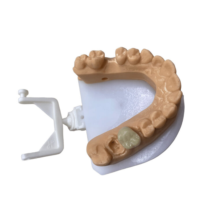 temporary lower teeth