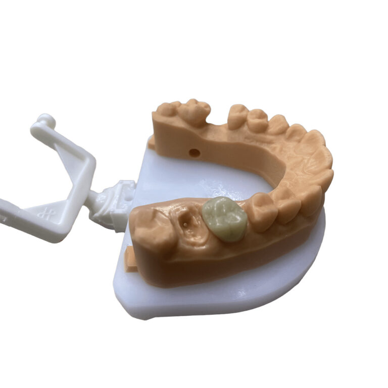 temporary lower teeth