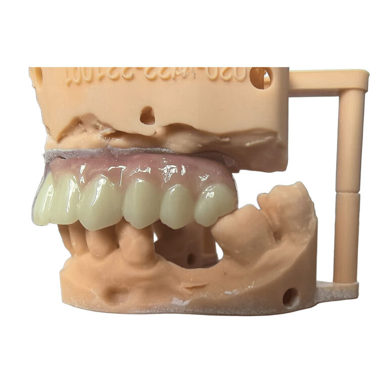 zirconia all on 4 (1)