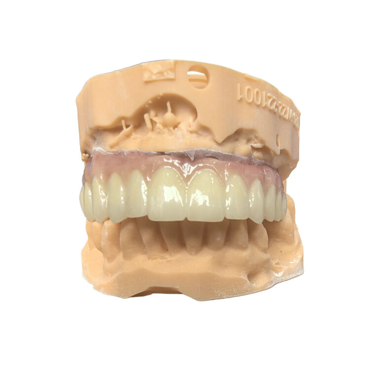 zirconia all on 4 dental implants