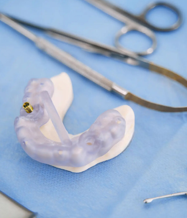 Custom Sleep Apnea Mouth Guard