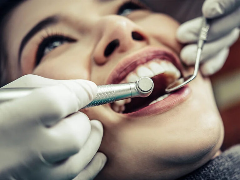 Dental Mirror