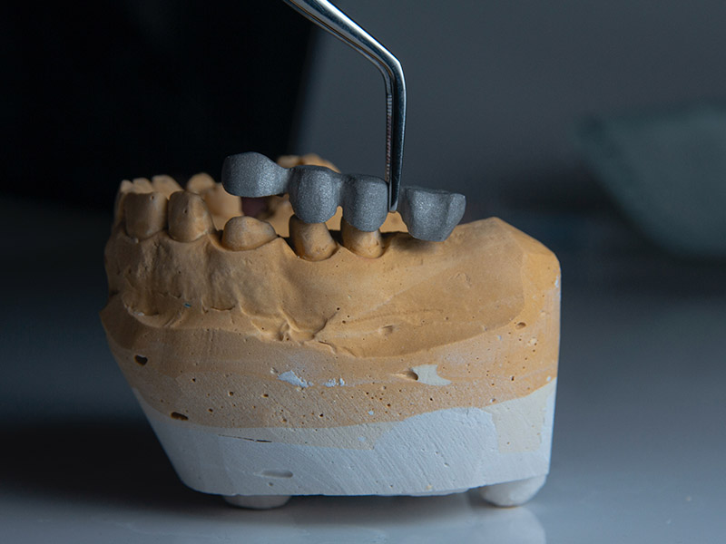 Dental Plaster