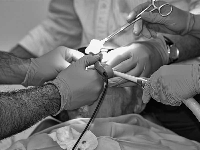 Dental anesthesia needles1