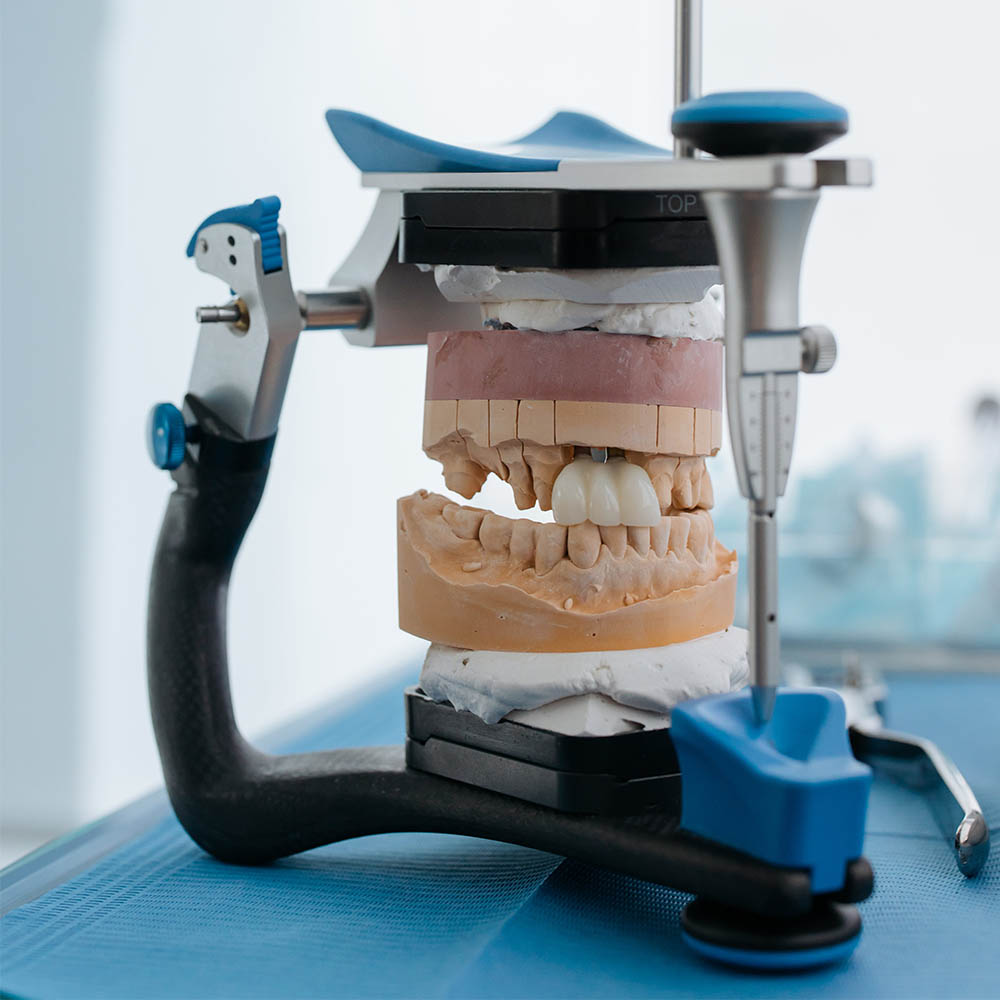 Dental bridge