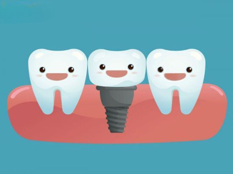 Denture Adaptation Period