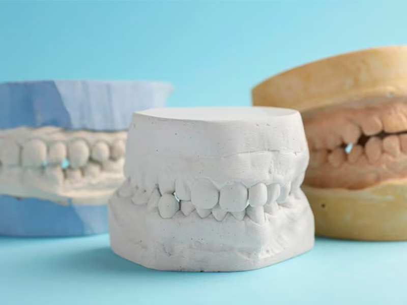 Different Types of Impression