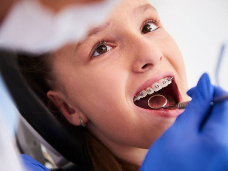Orthodontics for Children 2