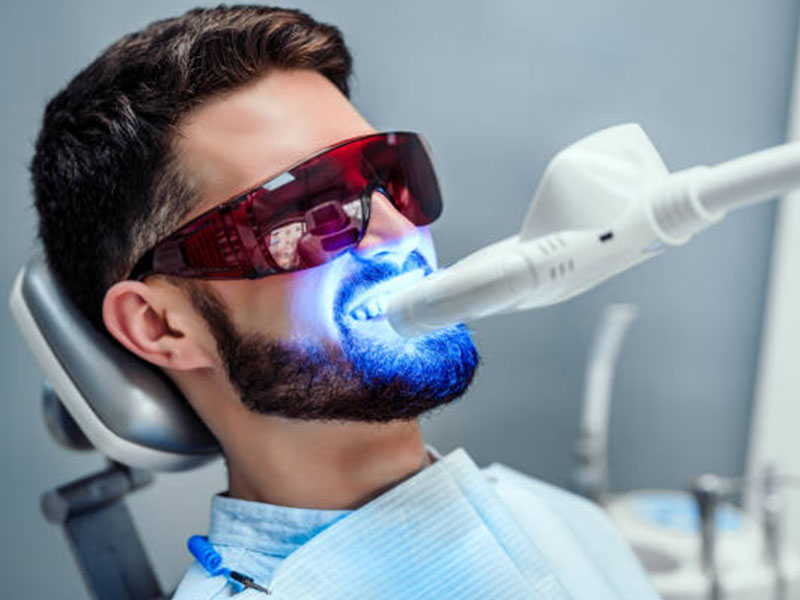 Teeth Whitening Lamp 1