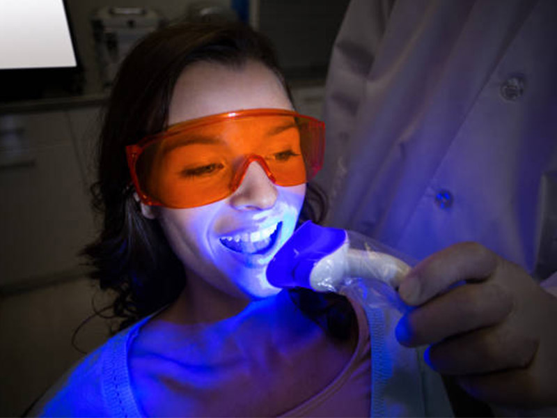 Teeth Whitening Lamp