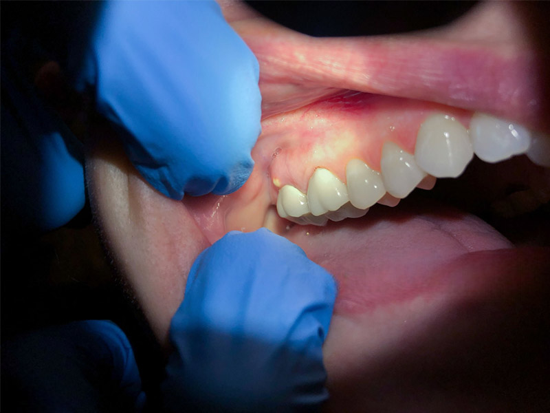 Understanding Hypodontia1 2