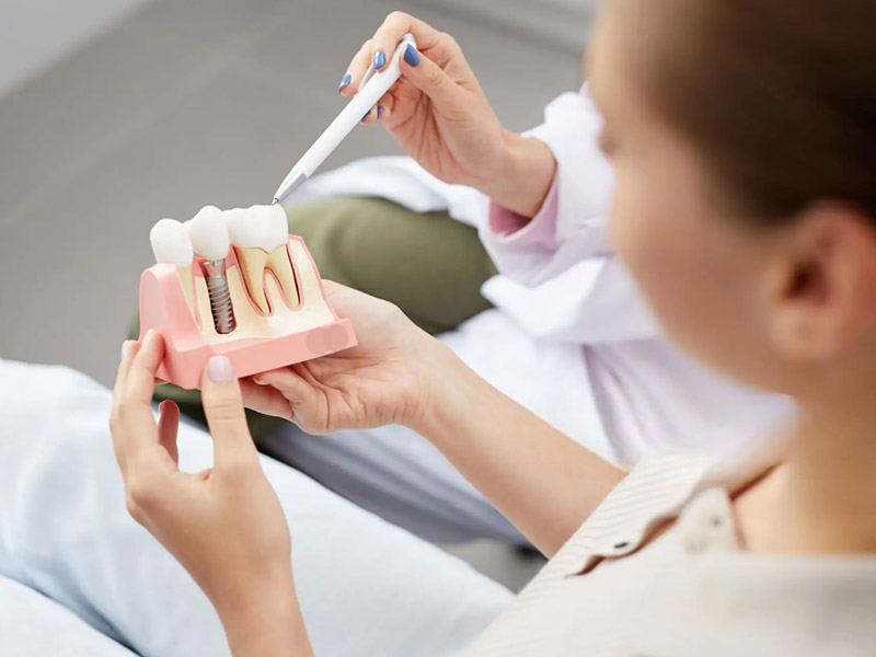 dental implant