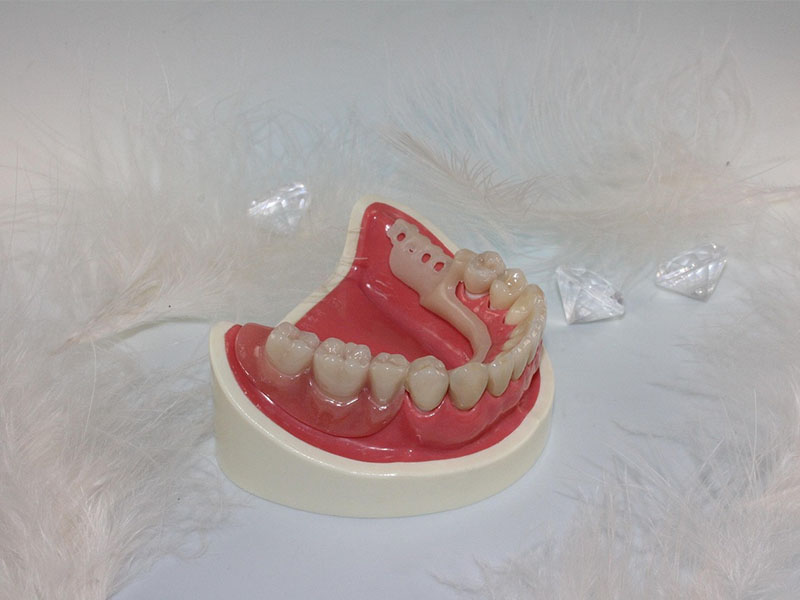 dental implants2