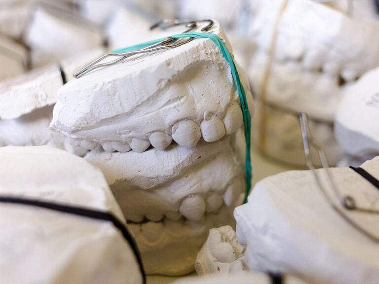 dental plaster