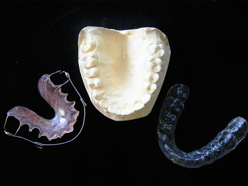 orthodontic brace