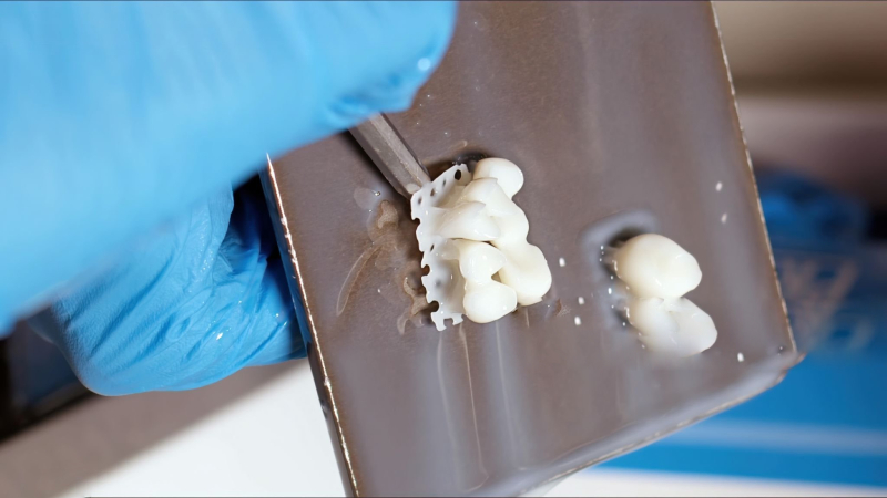 Bis-Acryl Composites Temporary Crown (1)