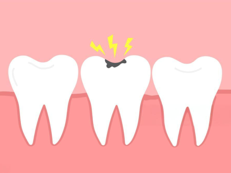 Cavity Fillings Hurt (3)
