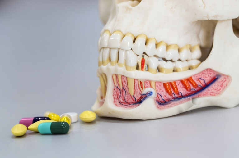 Complete NTI Appliance Guide for Dentists (1)
