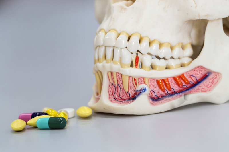 Complete NTI Appliance Guide for Dentists (1)