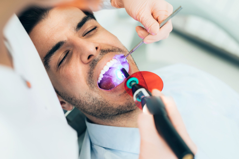 Composite tooth Bonding (1)
