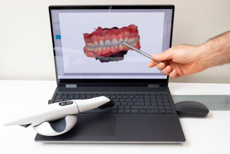 Consultation & Digital Smile Design (1)