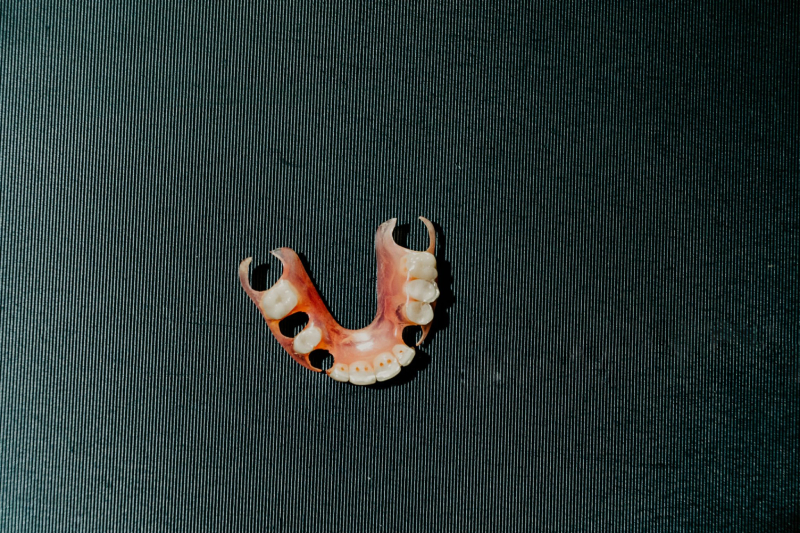 Flexible Partial Dentures (Valplast) (1)