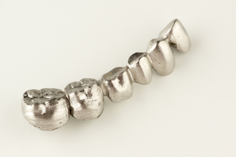 High-Noble Alloys PFM teeth (1)