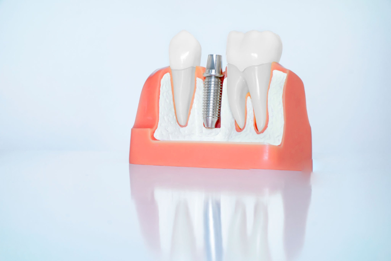 Implant Surface Coatings for Faster Bone Growth (1)