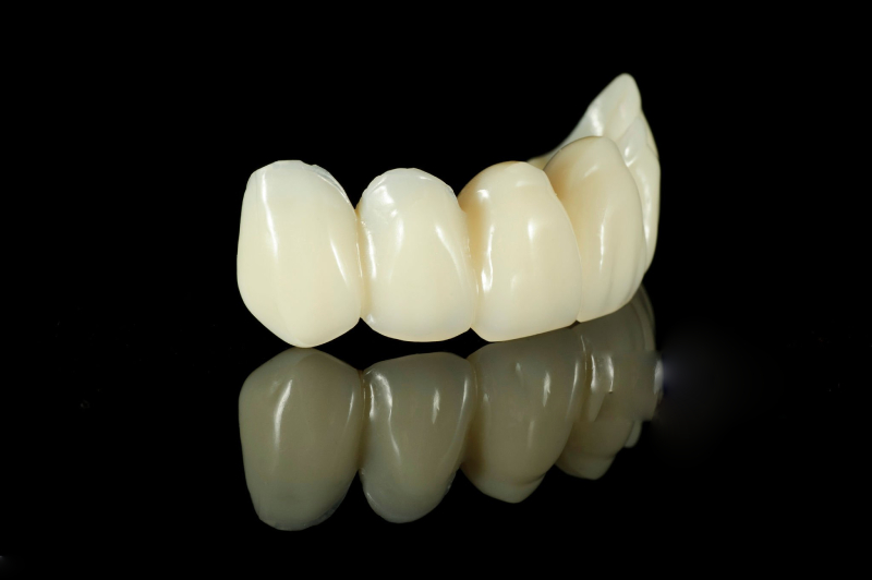 Multi-Layer Zirconia Crowns & Incisal Edge Characterization (1)