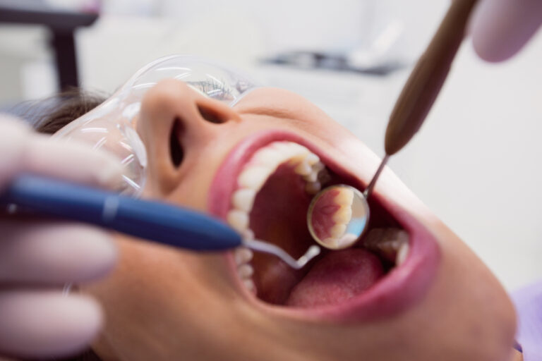 NPV and oral cancer (1)