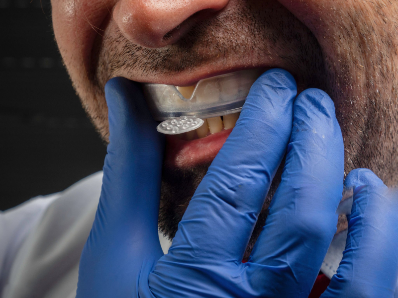 NTI dental Splint (1)