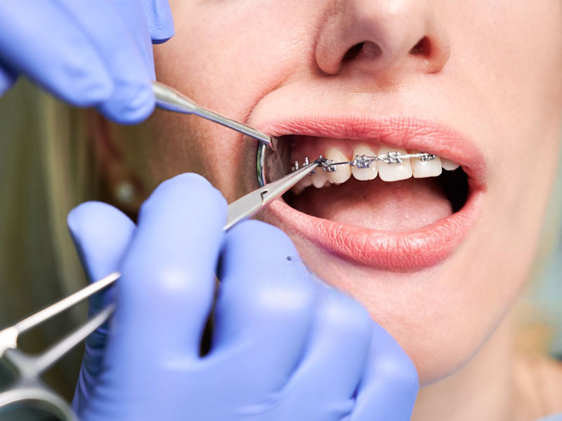 Orthodontic practice1