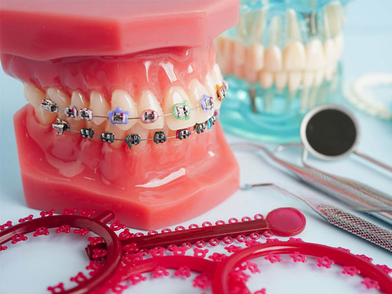 Orthodontic experiment