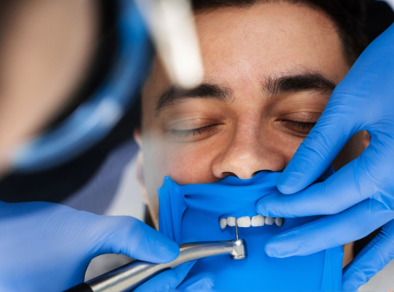 Teeth Prepared for Veneers (1)