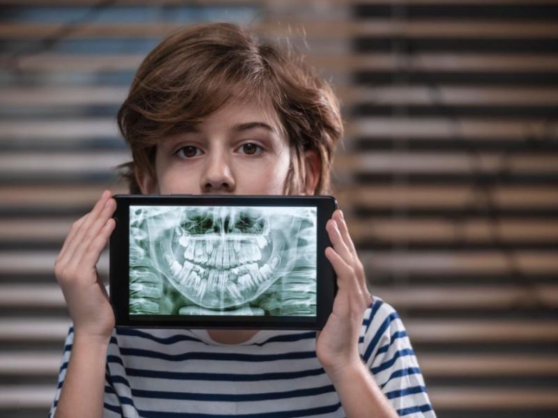 Teeth X-Rays for Children (1)