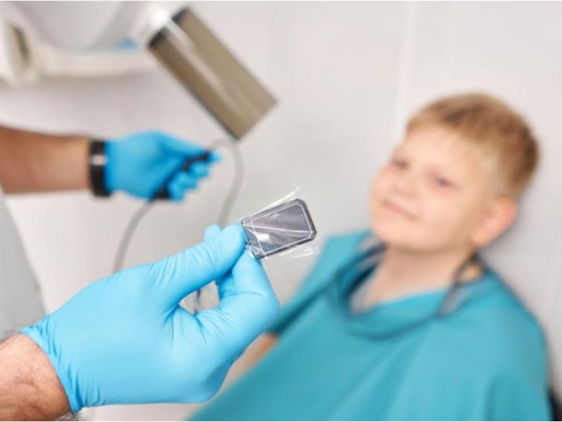 Teeth X-Rays for Children (3)