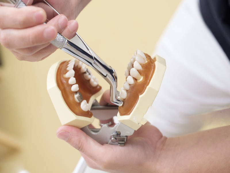 Tooth Replacement Options After Extraction (1)