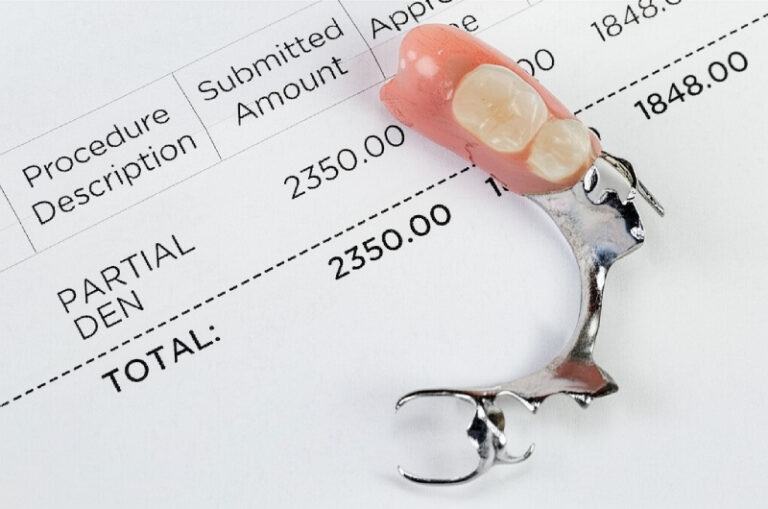 Types of Partial Dentures and Costs (1)