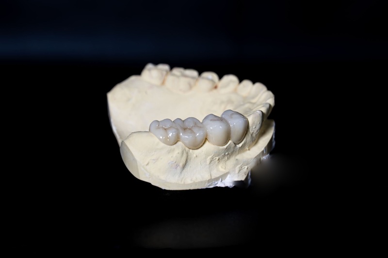 What is Zirconia (1)
