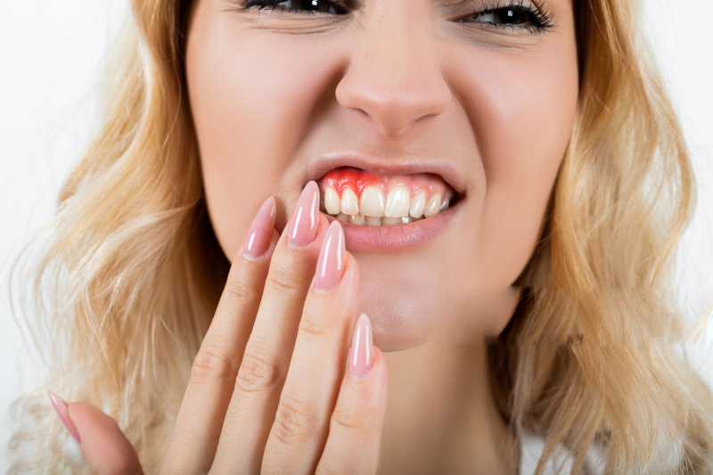 Why Do Implant Crowns Get Loose (1)