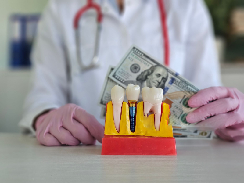dental Crown Costs in Different Places (1)