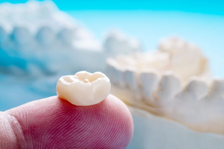 zirconia crowns problems (1)
