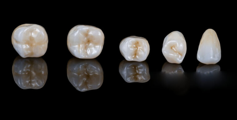 zirconia generations comparison, yttria-stabilized zirconia properties (1)
