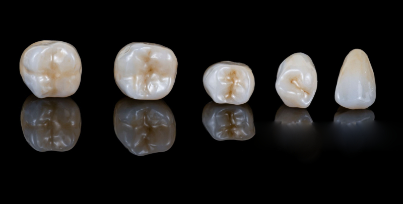 zirconia generations comparison, yttria-stabilized zirconia properties (1)