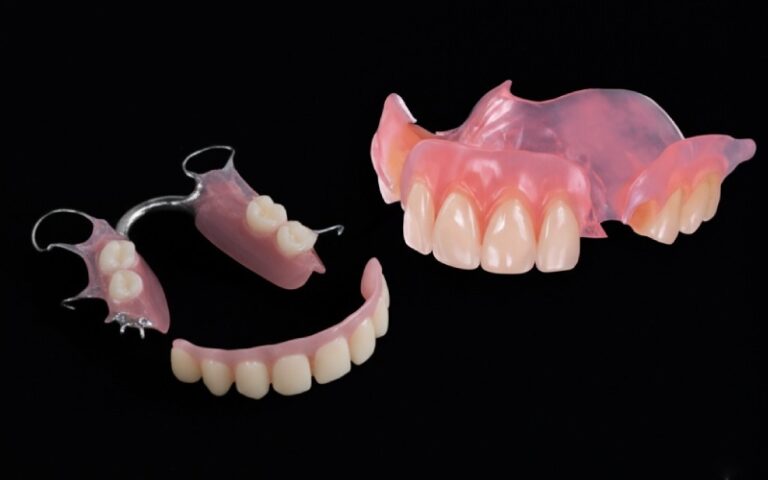 Comparison of flexible denture materials