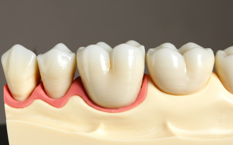 Cross-section of properly prepared tooth for ceramic crown