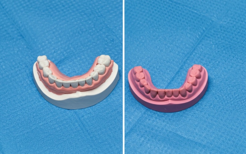 Dental model before and after wax rim placement