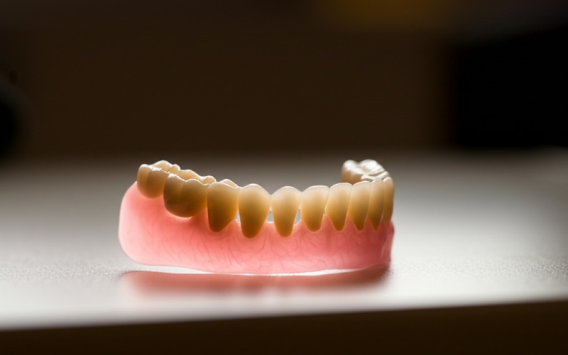 Flexible partial denture on dental model