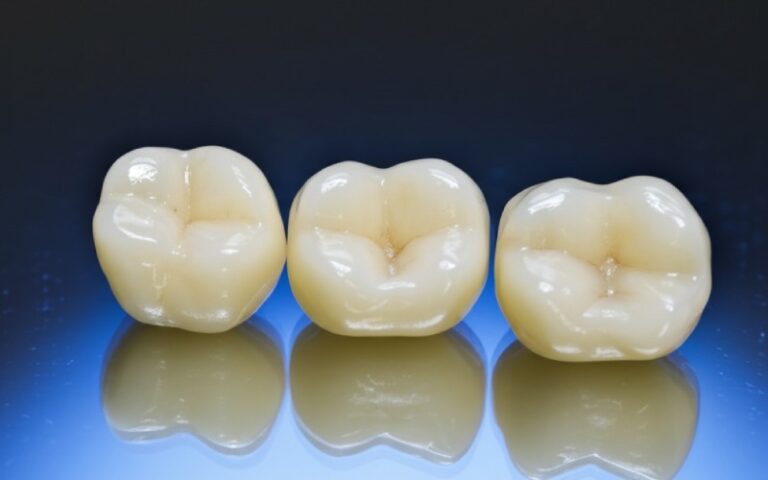 dental crowns in professional lighting